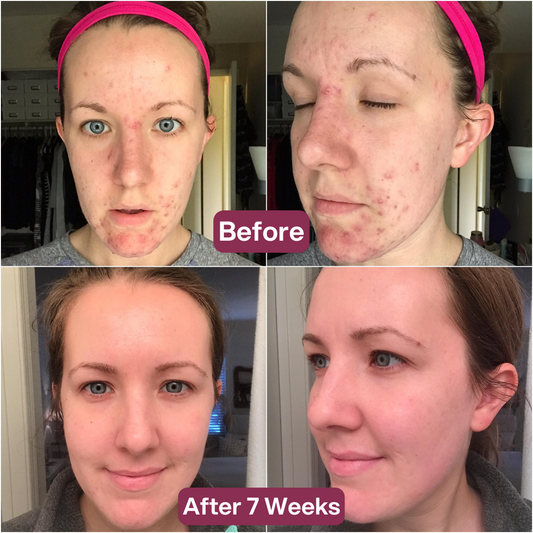 collagen Face sheet Mask winter special(pack of 4)