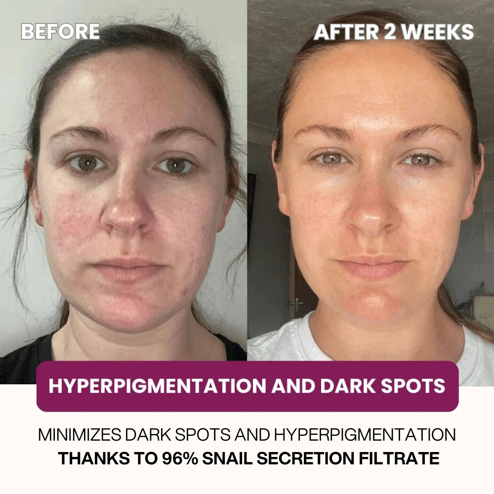 collagen Face sheet Mask winter special(pack of 4)