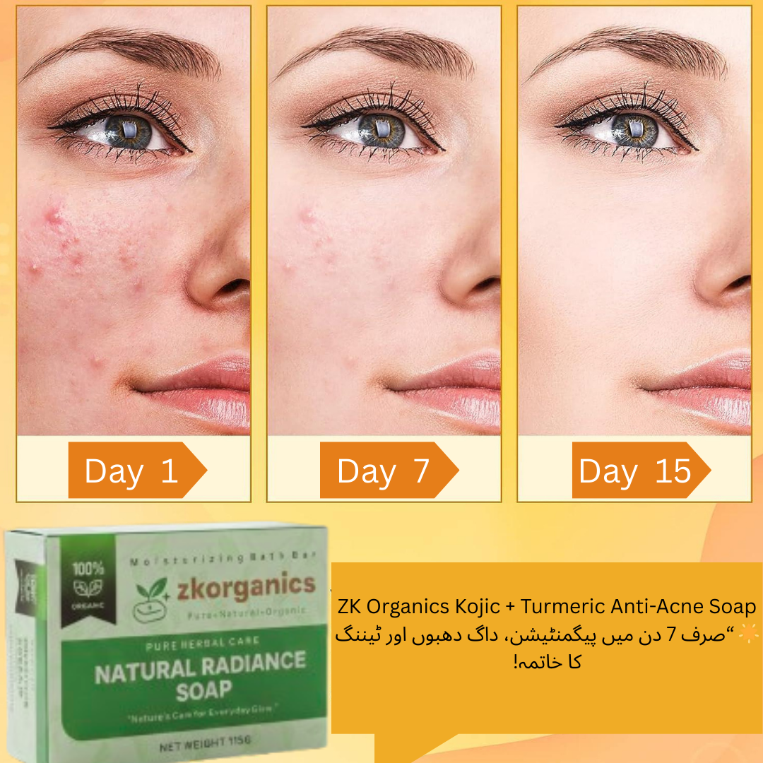 Turmeric+ kojic Acne clear soap (BUY 1 GET 1 FREE)
